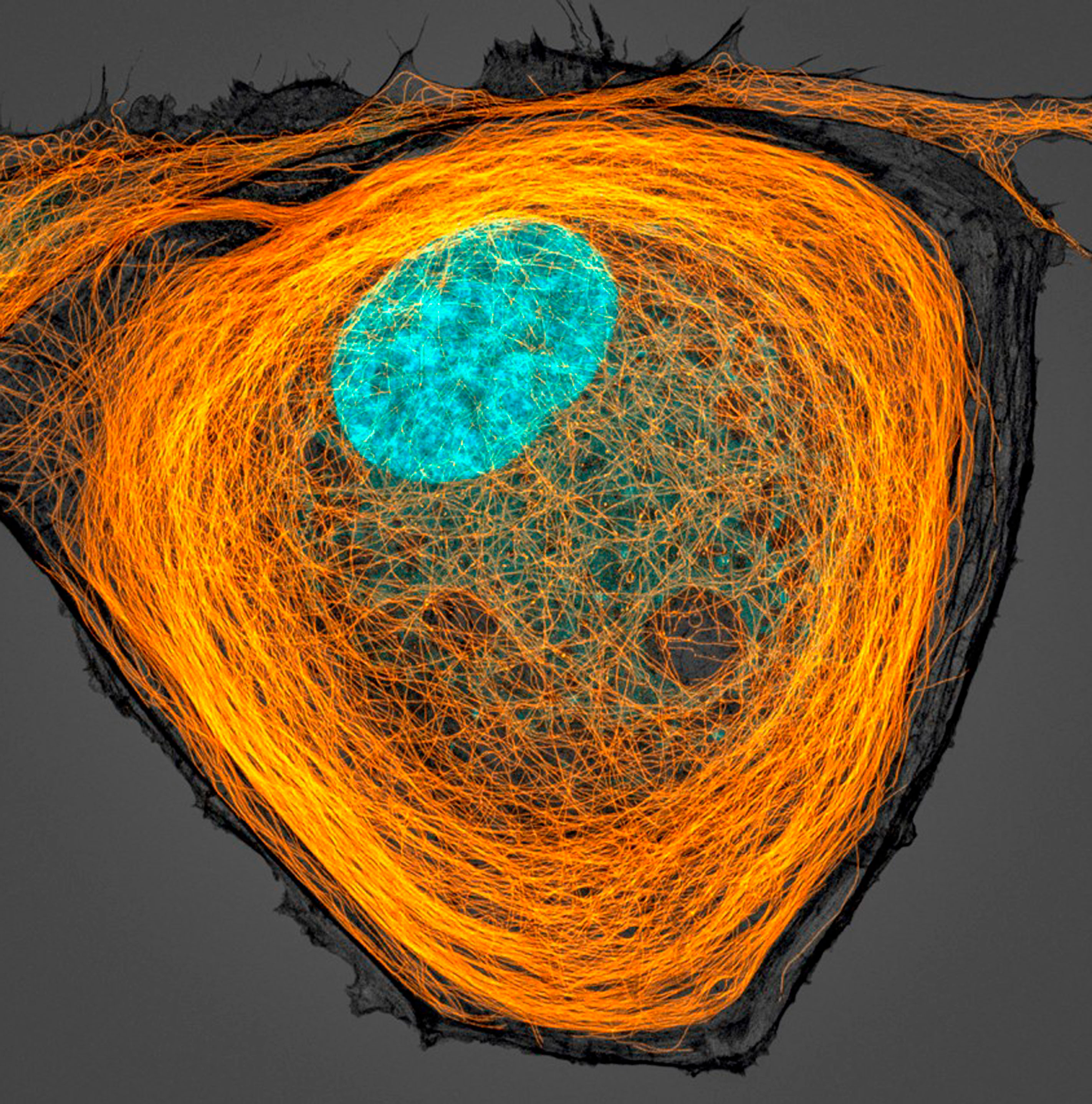 Микротрубочки (оранжевые) внутри клетки. Ядро показано голубым цветом