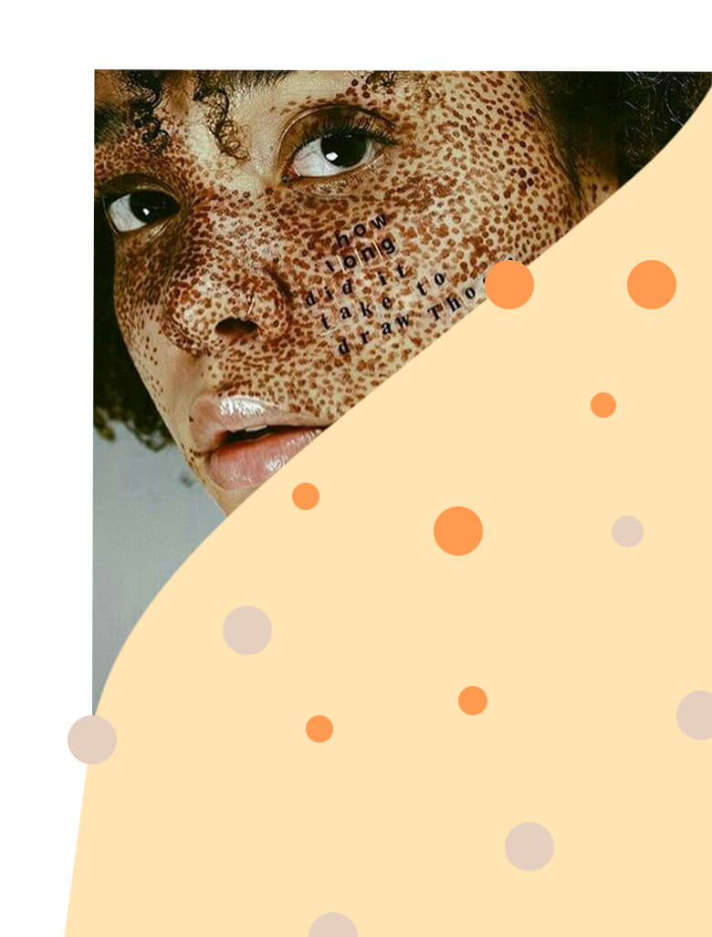 Пигментация кожи: причины и виды, профилактика - L’officiel