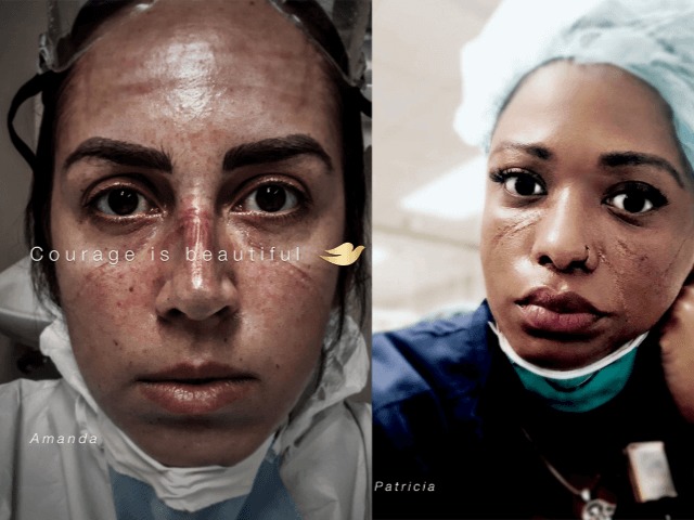 Courage is Beautiful: Dove показали видео с лицами медиков после часов работы в масках
