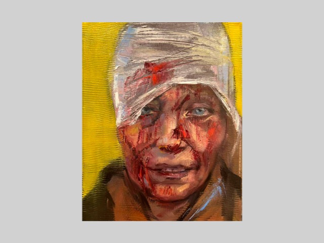 "Головний убір замінили бинти війни": Портрет пораненої під Чугуєвом українки продали за 100 тисяч доларів
